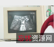 医院神秘B超剧情：奇葩结尾，视频1V-978M-24分